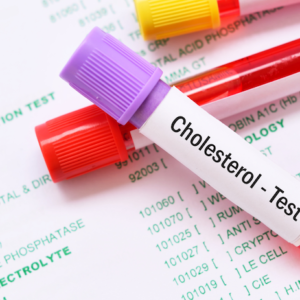 Cholesterol Testing by Genics Laboratories