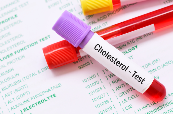 Cholesterol Testing by Genics Laboratories