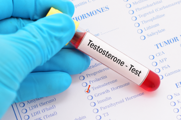 Testosterone Testing by Genics Laboratories