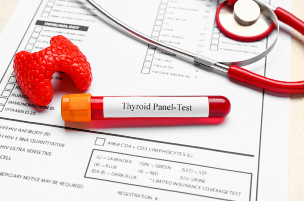 Thyroid testing by Genics Laboratories