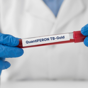 QuantiFERON Gold Standard test